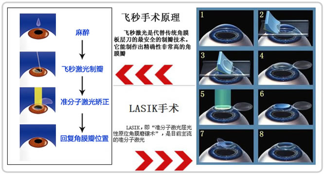 爱尔飞秒激光治疗近视 圆您参军梦 -征兵体检视